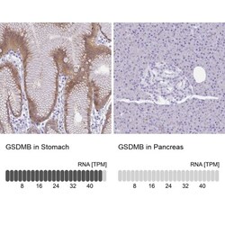 Gasdermin like Antibody, Novus Biologicals:Antibodies:Primary Antibodies